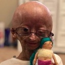 Adalia Rose